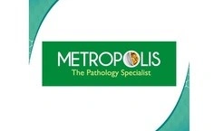 metropolis
